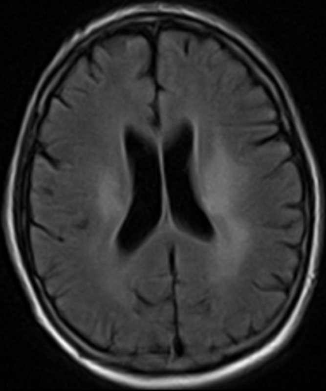 February 6, 2014 - Case of the Week | American Journal of Neuroradiology