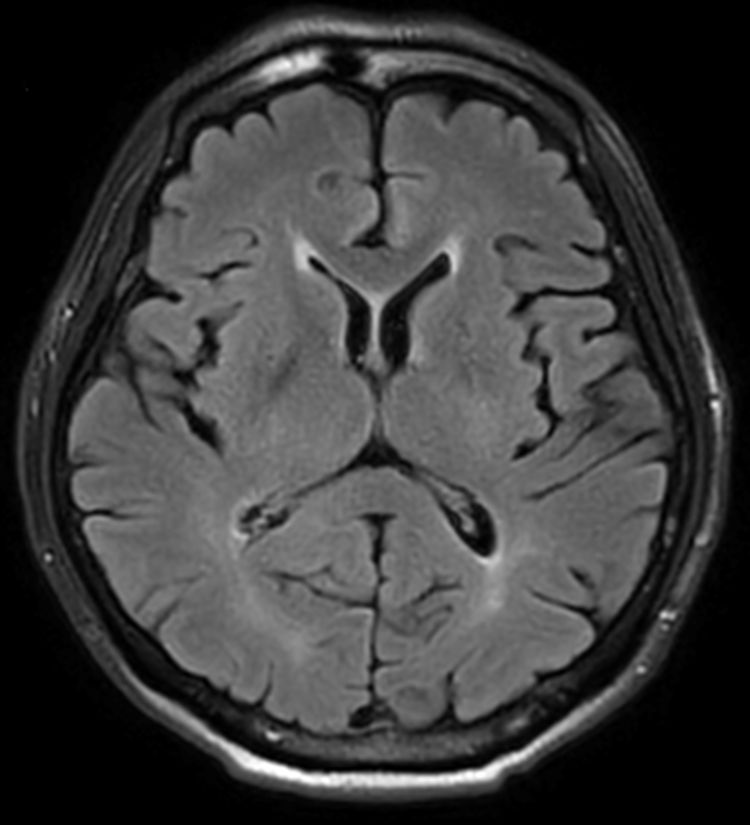 May 4, 2023 - Case of the Week | American Journal of Neuroradiology