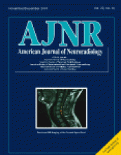 American Journal of Neuroradiology: 22 (10)