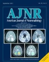 American Journal of Neuroradiology: 22 (8)