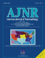American Journal of Neuroradiology: 22 (9)