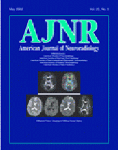 American Journal of Neuroradiology: 23 (5)