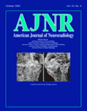 American Journal of Neuroradiology: 23 (9)