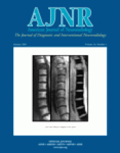 American Journal of Neuroradiology: 24 (1)