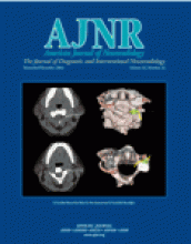 American Journal of Neuroradiology: 24 (10)