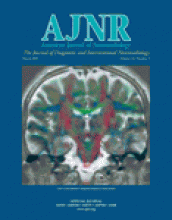 American Journal of Neuroradiology: 24 (3)