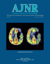 American Journal of Neuroradiology: 24 (5)