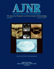 American Journal of Neuroradiology: 24 (7)