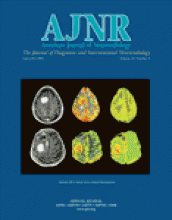 American Journal of Neuroradiology: 24 (8)