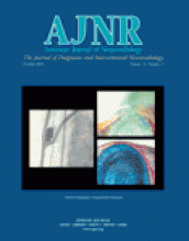American Journal of Neuroradiology: 24 (9)