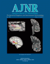 American Journal of Neuroradiology: 25 (5)