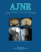 American Journal of Neuroradiology: 25 (6)