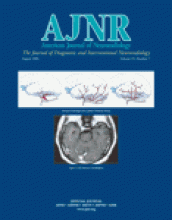 American Journal of Neuroradiology: 25 (7)
