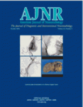 American Journal of Neuroradiology: 25 (9)