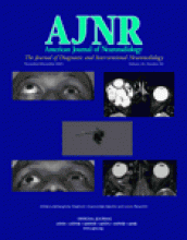 American Journal of Neuroradiology: 26 (10)