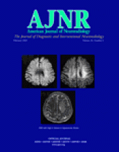 American Journal of Neuroradiology: 26 (2)