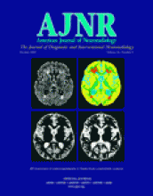 American Journal of Neuroradiology: 26 (9)
