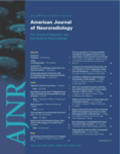 American Journal of Neuroradiology: 27 (1)