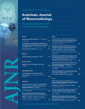 American Journal of Neuroradiology: 27 (5)