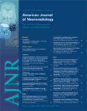 American Journal of Neuroradiology: 28 (1)