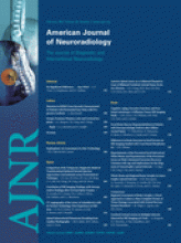 American Journal of Neuroradiology: 28 (2)