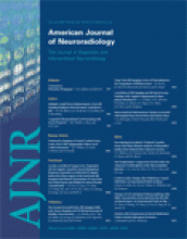 American Journal of Neuroradiology: 28 (6)