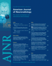 American Journal of Neuroradiology: 28 (7)