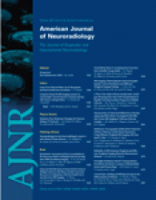 American Journal of Neuroradiology: 28 (9)