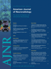 American Journal of Neuroradiology: 29 (1)