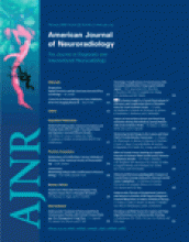 American Journal of Neuroradiology: 29 (2)