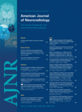 American Journal of Neuroradiology: 29 (3)