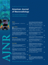 American Journal of Neuroradiology: 29 (5)