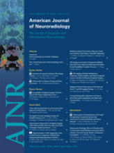 American Journal of Neuroradiology: 30 (1)