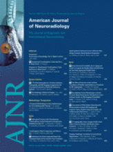 American Journal of Neuroradiology: 30 (10)