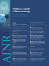 American Journal of Neuroradiology: 30 (2)