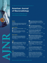 American Journal of Neuroradiology: 30 (4)