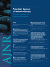 American Journal of Neuroradiology: 30 (5)