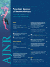 American Journal of Neuroradiology: 30 (9)