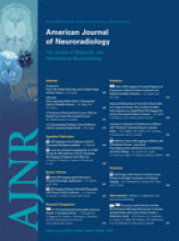 American Journal of Neuroradiology: 31 (3)