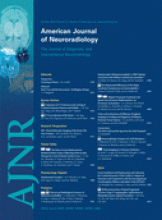 American Journal of Neuroradiology: 31 (9)