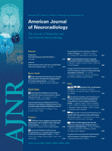 American Journal of Neuroradiology: 32 (10)
