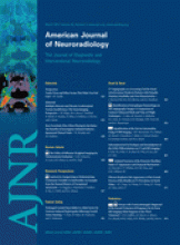 American Journal of Neuroradiology: 32 (3)