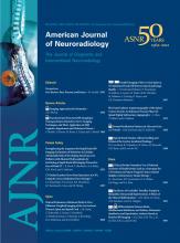 American Journal of Neuroradiology: 33 (10)
