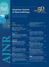 American Journal of Neuroradiology: 33 (11)