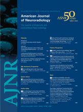 American Journal of Neuroradiology: 33 (6)