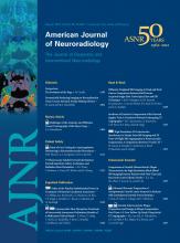 American Journal of Neuroradiology: 33 (7)