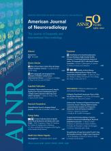 American Journal of Neuroradiology: 33 (8)