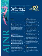 American Journal of Neuroradiology: 33 (9)