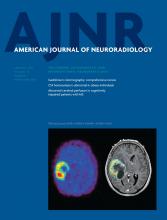 American Journal of Neuroradiology: 34 (1)