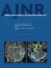 American Journal of Neuroradiology: 34 (10)